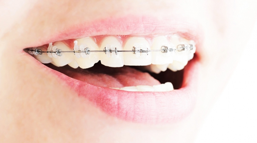 Imersão em Endodontia do Acesso à obturação