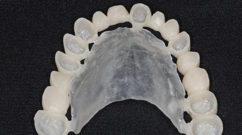 Imersão em Endodontia do Acesso à obturação