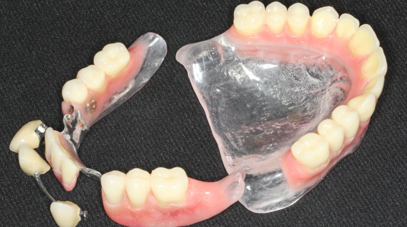 Imersão em Endodontia do Acesso à obturação