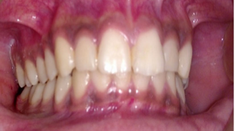 Especialização em Cirurgia e Traumatologia Bucomaxilofacial