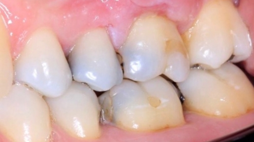 Especialização em Periodontia