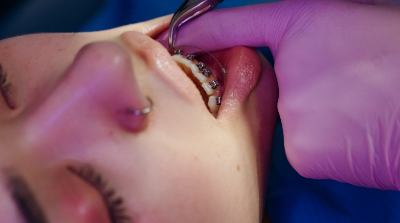 Especialização em Ortodontia com Ênfase na Odontologia Digital e Harmonização facial como complemento ao tratamento ortodôntico