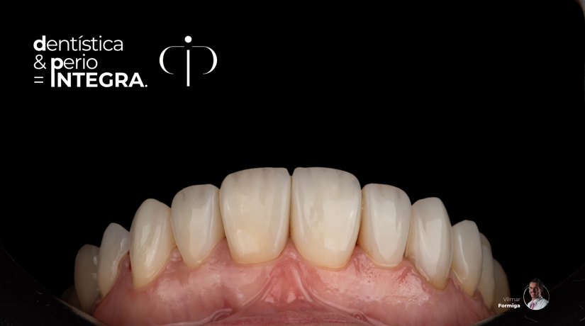 Aperfeiçoamento Integra - Dentística & Periodontia