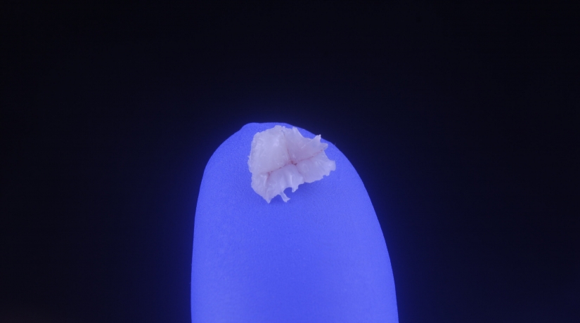 Especialização em Dentística com ênfase em Prótese Fixa