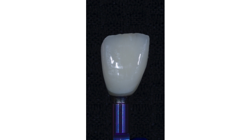 Imersão em Endodontia do Acesso à obturação
