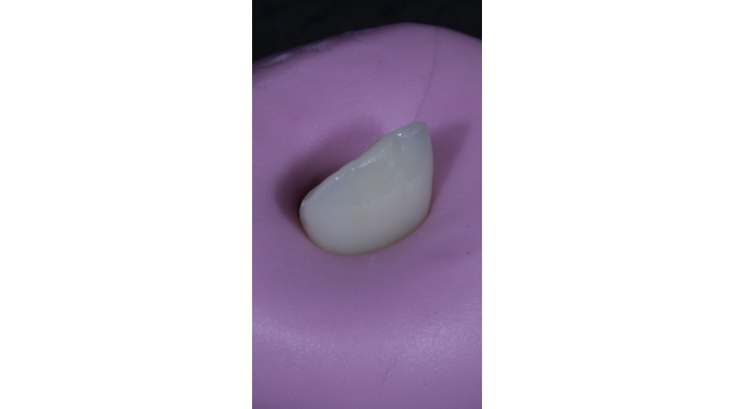 Imersão em Endodontia do Acesso à obturação