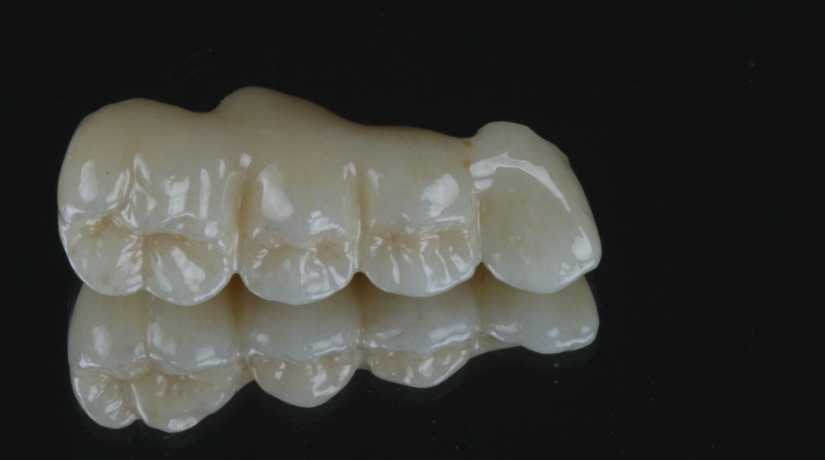 Imersão em Endodontia do Acesso à obturação
