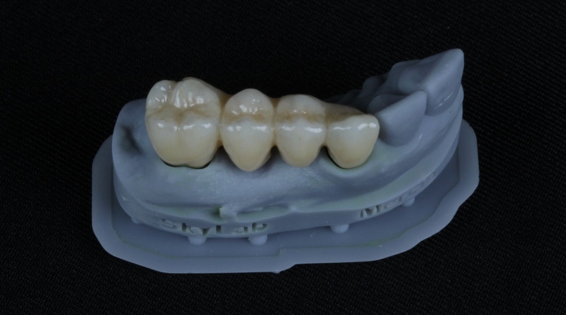 Imersão em Endodontia do Acesso à obturação